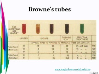 Browne's tubes
www.surgicalnote.co.uk/node/210
 