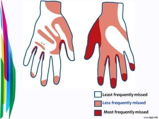 Least frequently missed
Less frequently missed
Most frequently missed
 