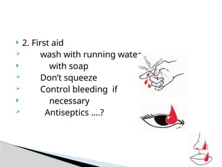  2. First aid
 wash with running water
 with soap
 Don’t squeeze
 Control bleeding if
 necessary
 Antiseptics ….?
 
