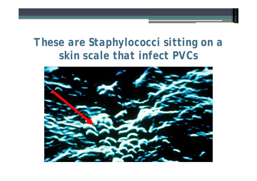 Infection control guidelines for Prevention of Peripheral Venous Cath…