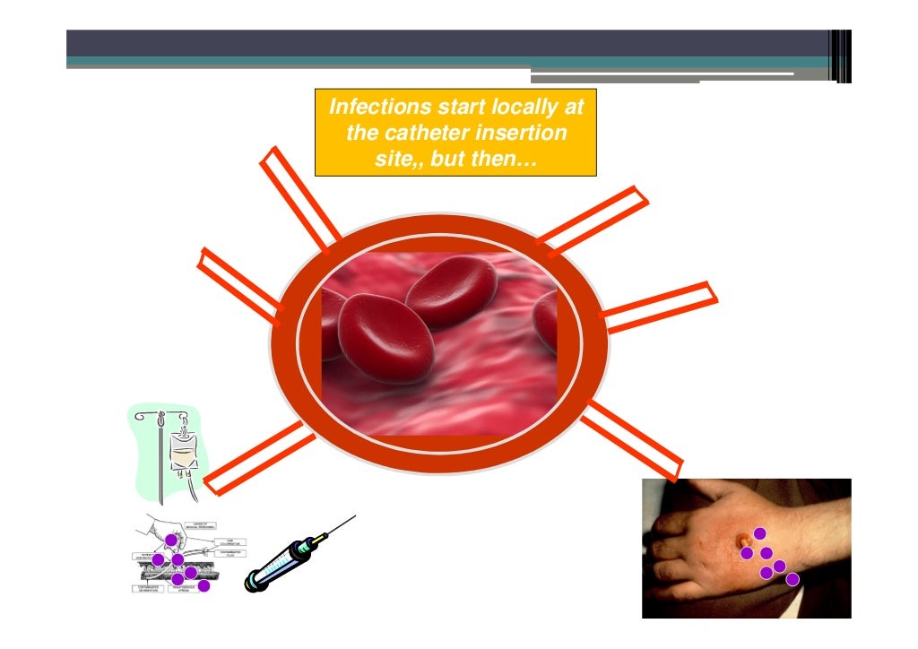 Infection control guidelines for Prevention of Peripheral Venous Cath…