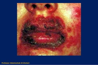 Dr. Abdulwahab Al-kholaniProfessor Abdulwahab Al-kholani
 