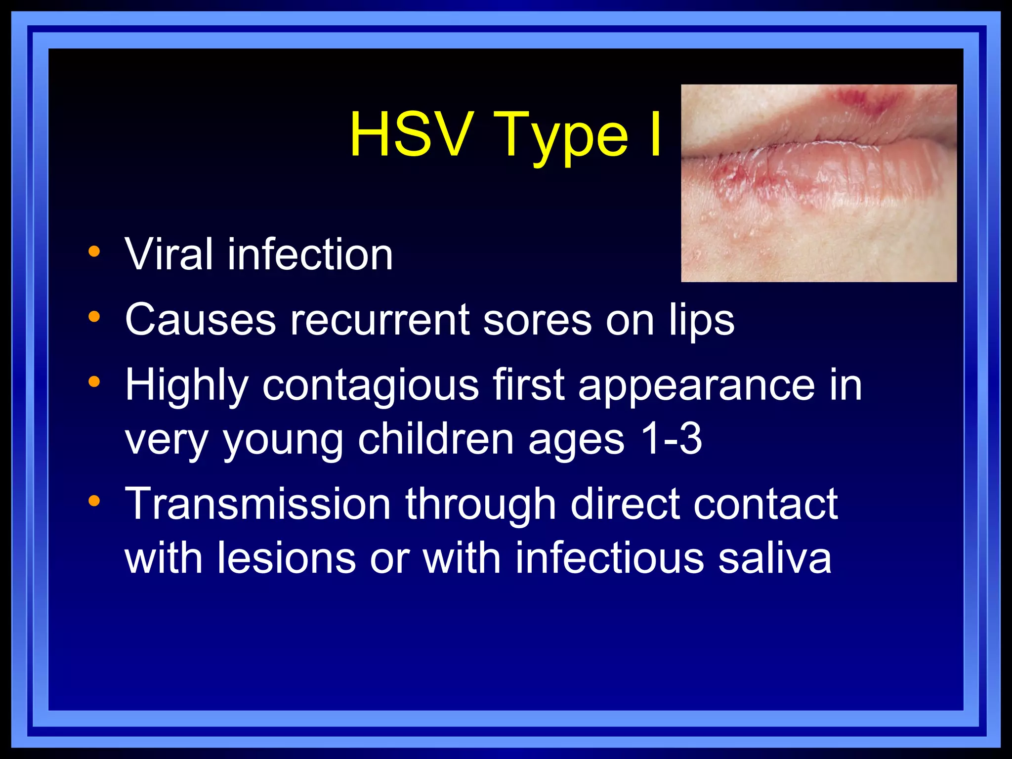 HSV Type I
• Viral infection
• Causes recurrent sores on lips
• Highly contagious first appearance in
  very young children ages 1-3
• Transmission through direct contact
  with lesions or with infectious saliva
 