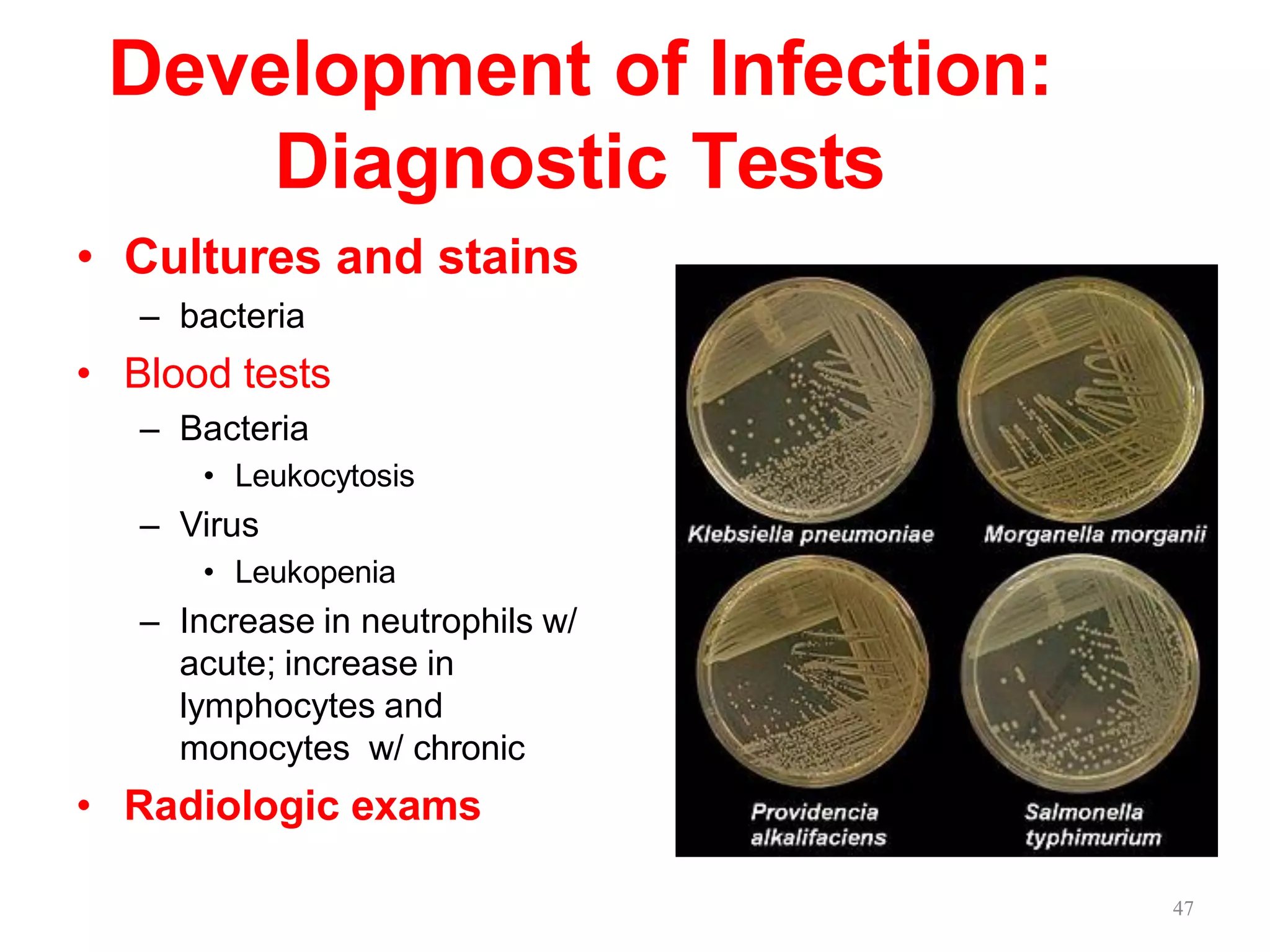 Development of Infection:
Diagnostic Tests
• Cultures and stains
– bacteria
• Blood tests
– Bacteria
• Leukocytosis
– Virus
• Leukopenia
– Increase in neutrophils w/
acute; increase in
lymphocytes and
monocytes w/ chronic
• Radiologic exams
47
 