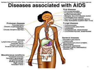 Obsense Infection Infection intro | PDF