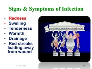 INFECTION Basics on Transmission and Prevention | PPTX