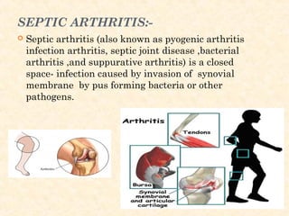 SEPTIC ARTHRITIS:-
 Septic arthritis (also known as pyogenic arthritis
infection arthritis, septic joint disease ,bacterial
arthritis ,and suppurative arthritis) is a closed
space- infection caused by invasion of synovial
membrane by pus forming bacteria or other
pathogens.
 