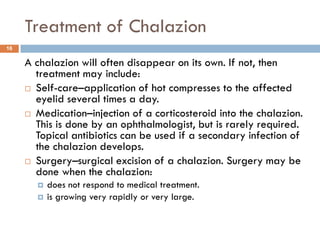 infection of eye and cataract.pdf
