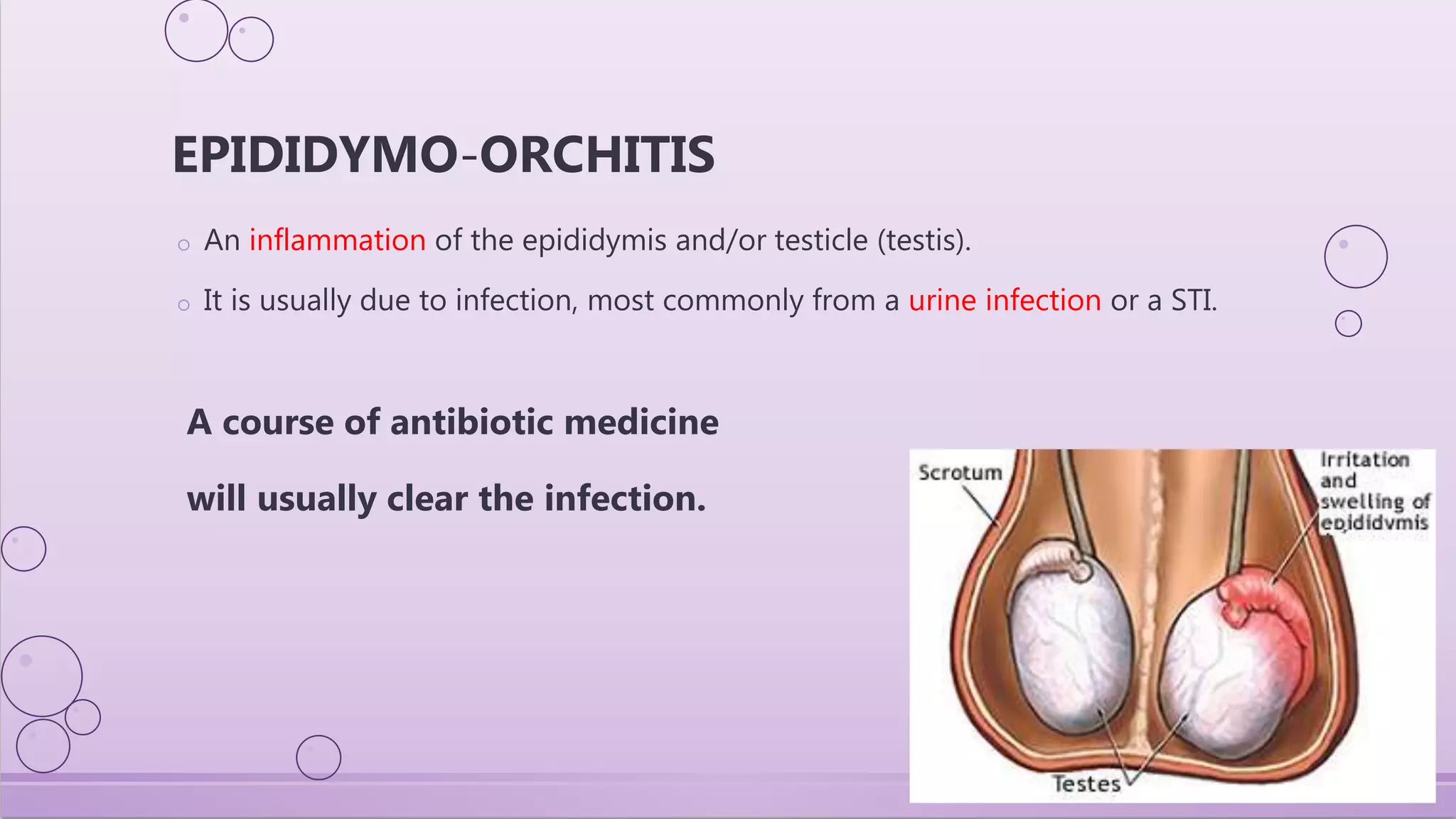 Infection of male reproductive system | PPTX
