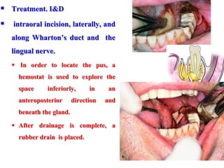  Treatment. I&D
 intraoral incision, laterally, and
along Wharton’s duct and the
lingual nerve.
 In order to locate the pus, a
hemostat is used to explore the
space inferiorly, in an
anteroposterior direction and
beneath the gland.
 After drainage is complete, a
rubber drain is placed.
 