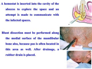 A hemostat is inserted into the cavity of the
abscess to explore the space and an
attempt is made to communicate with
the infected spaces.
Blunt dissection must be performed along
the medial surface of the mandibular
bone also, because pus is often located in
this area as well. After drainage, a
rubber drain is placed.
 