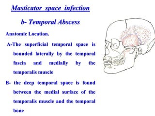 Masticator space infection
b- Temporal Abscess
Anatomic Location.
A-The superficial temporal space is
bounded laterally by the temporal
fascia and medially by the
temporalis muscle
B- the deep temporal space is found
between the medial surface of the
temporalis muscle and the temporal
bone
 