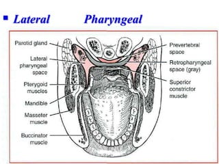  Lateral Pharyngeal
Abscess

 