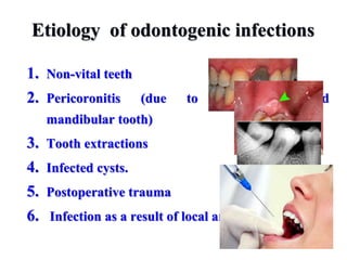 Etiology of odontogenic infections
1. Non-vital teeth
2. Pericoronitis (due to a semi-impacted
mandibular tooth)
3. Tooth extractions
4. Infected cysts.
5. Postoperative trauma
6. Infection as a result of local anesthesia.
 