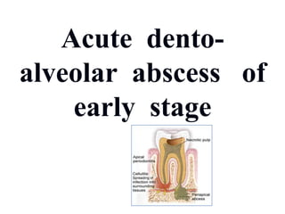 Acute dento-
alveolar abscess of
early stage
 