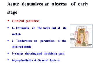 Acute dentoalveolar abscess of early
stage
 Clinical pictures:
 1- Extrusion of the tooth out of its
socket.
 2- Tenderness: on percussion of the
involved tooth
 3- sharp , shooting and throbbing pain
 4-lymphadinitis & General features
 