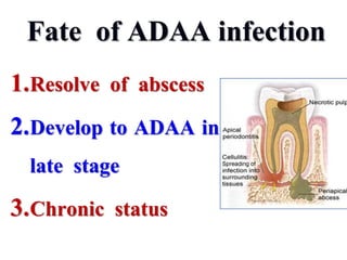 Fate of ADAA infection
1.Resolve of abscess
2.Develop to ADAA in
late stage
3.Chronic status
 