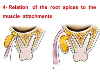 4- Relation of the root apices to the
muscle attachments
 