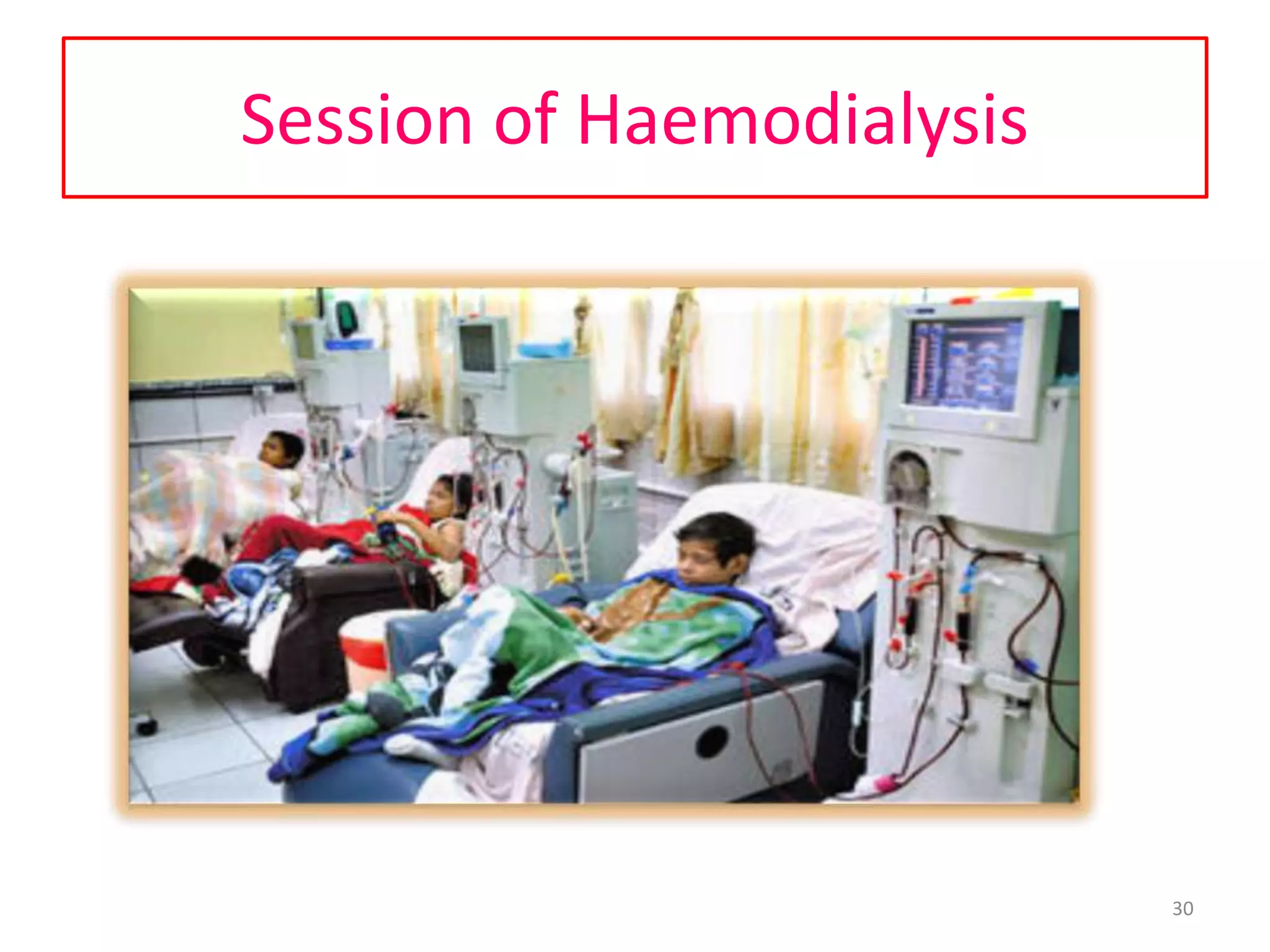 Session of Haemodialysis
30
 
