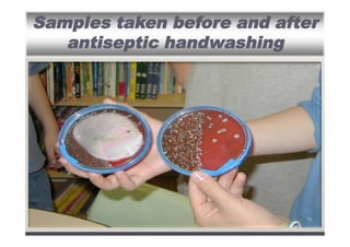 Samples taken before and after
antiseptic handwashing

٣٤

 