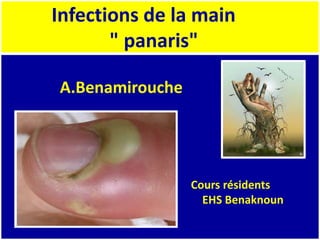 Infections de la main
" panaris"
A.Benamirouche
Cours résidents
EHS Benaknoun
 