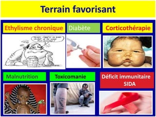 Terrain favorisant
Ethylisme chronique Diabète Corticothérapie
Déficit immunitaire
SIDA
Toxicomanie
Malnutrition
 