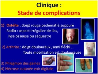 1) Ostéite : doigt rouge,oedématié,suppuré
Radio : aspect irrégulier de l’os,
lyse osseuse ou séquestre
2) Arthrite : doigt douloureux ,semi fléchi .
Toute mobilisation est douloureuse
3) Phlegmon des gaines
4) Nécrose cutanée voir digitale
Clinique :
Stade de complications
 
