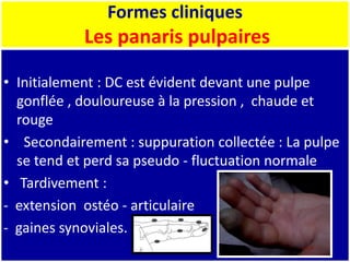 Formes cliniques
Les panaris pulpaires
• Initialement : DC est évident devant une pulpe
gonflée , douloureuse à la pression , chaude et
rouge
• Secondairement : suppuration collectée : La pulpe
se tend et perd sa pseudo - fluctuation normale
• Tardivement :
- extension ostéo - articulaire
- gaines synoviales.
 