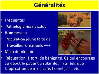 Généralités
• Fréquentes
• Pathologie mains sales
• Hommes+++
• Population jeune faite de
travailleurs manuels +++
• Main dominante
• Réputation, à tort, de bénignité. Ce qui encourage
au début le patient à subir des Trts tels que
l’application de miel, café, henné ,ail …etc.
 