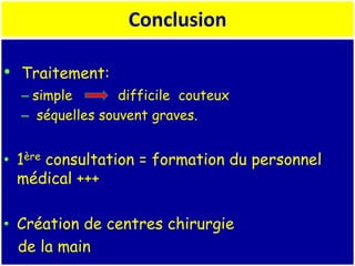 • Traitement:
– simple difficile couteux
– séquelles souvent graves.
• 1ère consultation = formation du personnel
médical +++
• Création de centres chirurgie
de la main
Conclusion
 