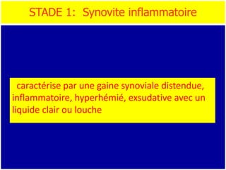 STADE 1: Synovite inflammatoire
caractérise par une gaine synoviale distendue,
inflammatoire, hyperhémié, exsudative avec un
liquide clair ou louche
 