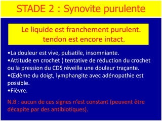 STADE 2 : Synovite purulente
•La douleur est vive, pulsatile, insomniante.
•Attitude en crochet ( tentative de réduction du crochet
ou la pression du CDS réveille une douleur traçante.
•Œdème du doigt, lymphangite avec adénopathie est
possible.
•Fièvre.
N.B : aucun de ces signes n’est constant (peuvent être
décapite par des antibiotiques).
Le liquide est franchement purulent.
tendon est encore intact.
 