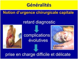 Généralités
Notion d’urgence chirurgicale capitale
retard diagnostic
complications
évolutives
prise en charge difficile et délicate
 