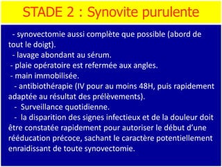 STADE 2 : Synovite purulente
- synovectomie aussi complète que possible (abord de
tout le doigt).
- lavage abondant au sérum.
- plaie opératoire est refermée aux angles.
- main immobilisée.
- antibiothérapie (IV pour au moins 48H, puis rapidement
adaptée au résultat des prélèvements).
- Surveillance quotidienne.
- la disparition des signes infectieux et de la douleur doit
être constatée rapidement pour autoriser le début d’une
rééducation précoce, sachant le caractère potentiellement
enraidissant de toute synovectomie.
 