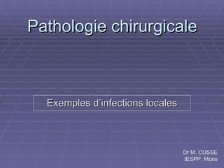 Pathologie chirurgicale Exemples d’infections locales Dr M. CUSSE IESPP, Mons 