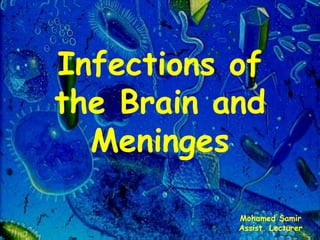 Infections of
the Brain and
Meninges
Mohamed Samir
Assist. Lecturer
 