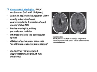  Cryptococcal Meningitis : MC;C.
neoformans (soil with bird feces)
• common opportunistic infection in HIV
• usually subacute/chronic
course;headache & malaise,altered
mental status 20%
• basilar meningitis, miliary
parenchymal nodules
• infiltrate brain via the perivascular
spaces
• dilation of perivascular spaces c/a
“gelatinous pseudocyst presentation”
• mortality of HIV-associated
cryptococcal meningitis 22-40%
despite Rx
Cryptococcosis
HIV Pt.; Axial T2-w (A) & T1-w CE (B)- single small,
enhancing lesion in left corona radiata with moderate
associated edema
 
