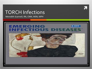 
TORCH Infections
Meredith Scannell, RN, CNM, MSN, MPH
 