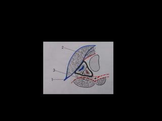 Infectionsofhn 140721030712-phpapp02