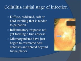 Cellulitis: initial stage of infection
 Diffuse, reddened, soft or
hard swelling that is tender
to palpation.
 Inflammatory response not
yet forming a true abscess.
 Microorganisms have just
begun to overcome host
defenses and spread beyond
tissue planes.
 