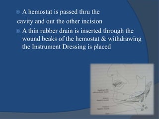 A hemostat is passed thru the
cavity and out the other incision
 A thin rubber drain is inserted through the
wound beaks of the hemostat & withdrawing
the Instrument Dressing is placed
 
