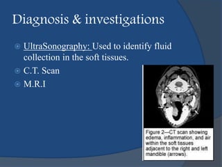 Diagnosis & investigations
 UltraSonography: Used to identify fluid
collection in the soft tissues.
 C.T. Scan
 M.R.I
 