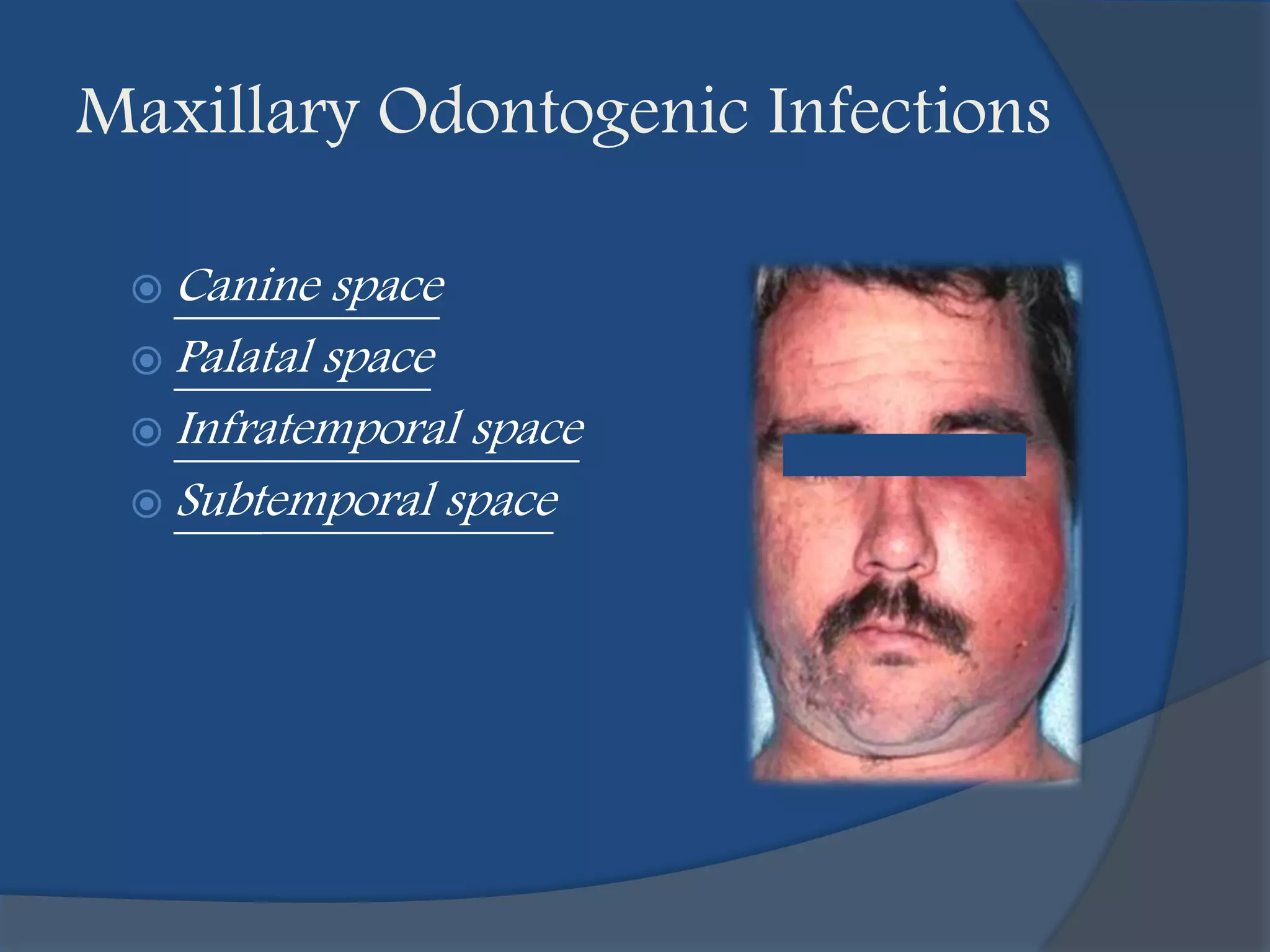 Infections of head and neck | PPTX
