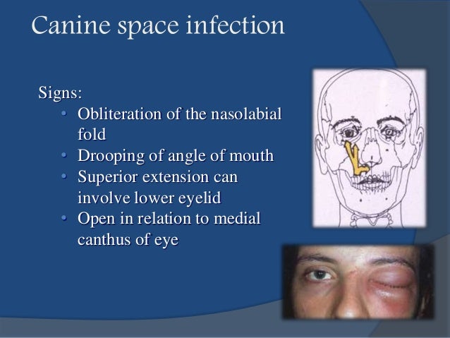 canine infections incision
