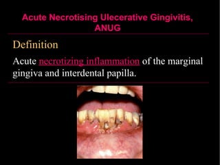 Infections of oral & para-oral tissues | PPT