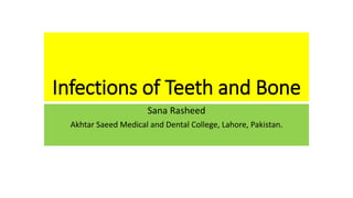 Infections of Teeth and Bone
Sana Rasheed
Akhtar Saeed Medical and Dental College, Lahore, Pakistan.
 