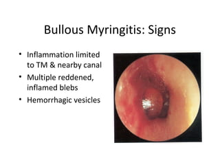 Ear Infection Redness Infections of the external ear | PPT