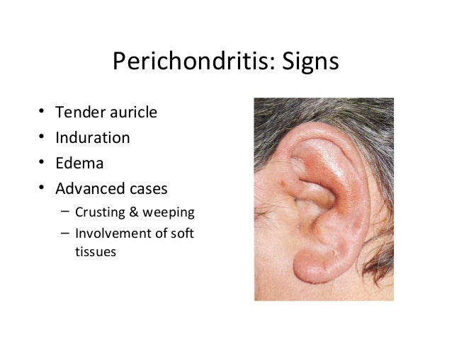 Infections of the external ear