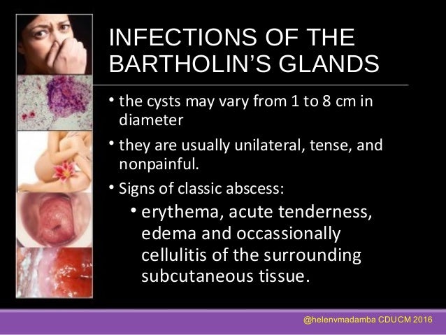 Infections Of The Genital Tract Part I Infections Of The Genital Tract Part I