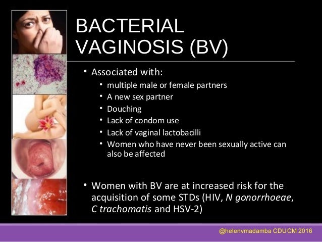 Infections Of The Genital Tract Part Ii